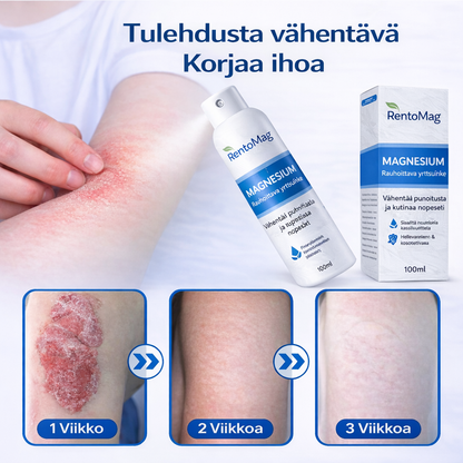 RentoMag™ – Magnesiumsuihke herkälle ja ärtyneelle iholle