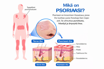 RentoMag™ – Magnesiumsuihke herkälle ja ärtyneelle iholle
