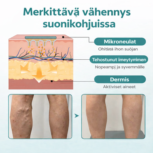 VenaLievä™ – Mikroneulalaastari raskaiden jalkojen ja suonten tueksi