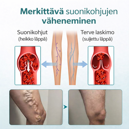 VenaLievä™ – Mikroneulalaastari raskaiden jalkojen ja suonten tueksi