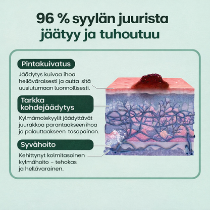 IhoKirkas™ ChillErase – täsmällisesti viilentävä suihke sileämmälle iholle